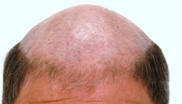 Product picture The Whole Bald Truth and Nothing But The Truth